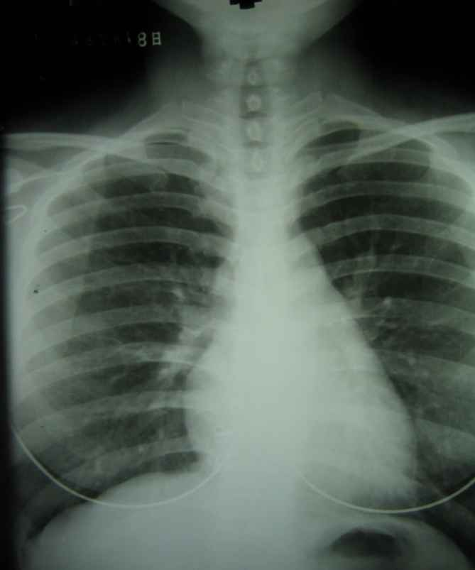 <p>Does this radiograph have good or bad technique?</p>