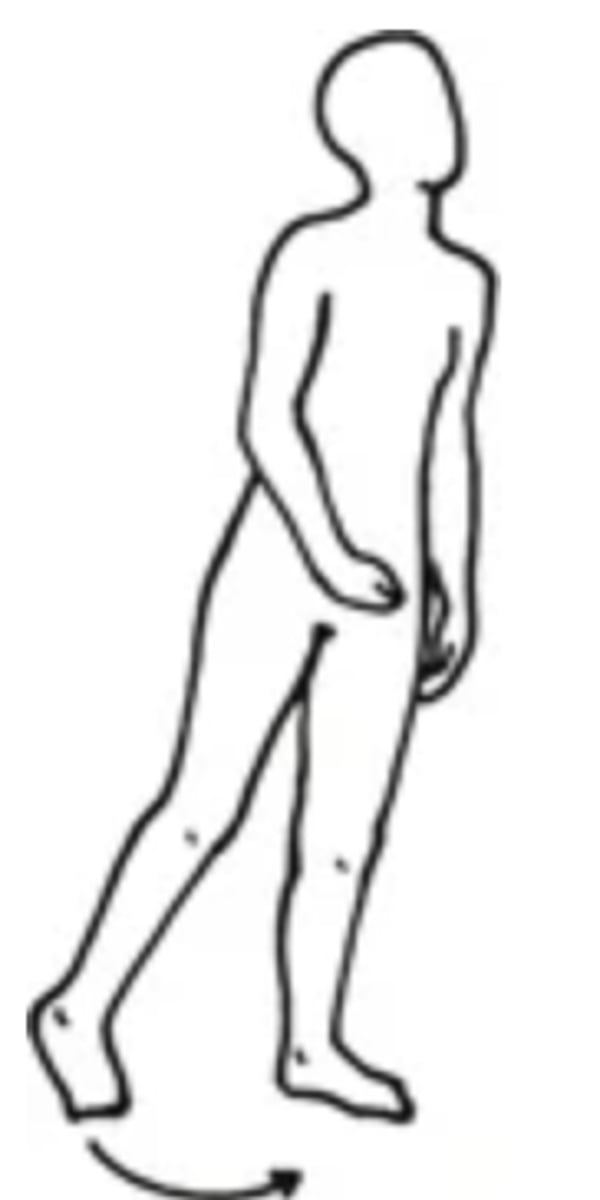 <p>- An abnormal gait in which one side of the body is paralyzed</p><p>- Can be caused by a head trauma</p>