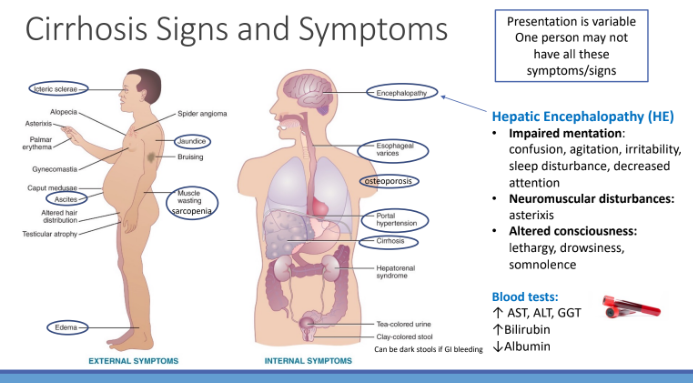 <p>↑ AST, ALT, GGT</p><p>↑Bilirubin</p><p>↓Albumin</p>