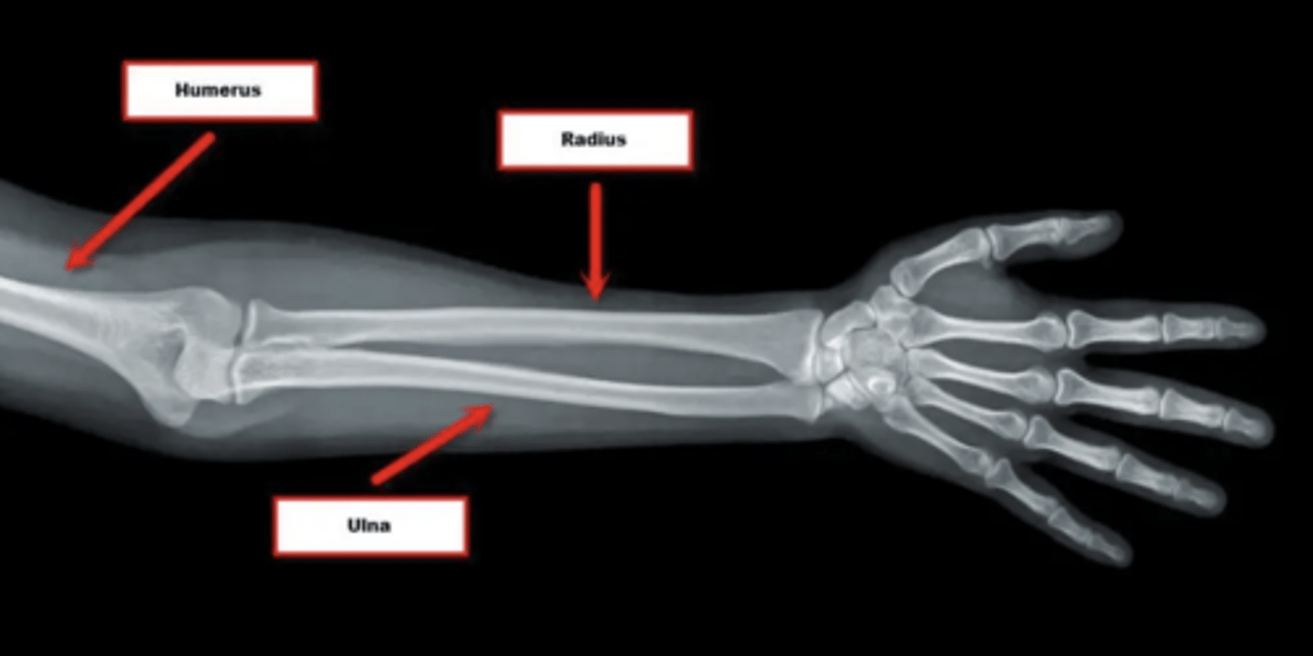 <p>The articular surface of the radius is flat and confronted with the round-shaped humeral condyle, allowing wide mobility in both flexo-extension and rotation.</p>