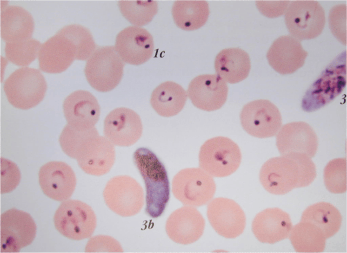 <p>Only ring forms and gametocytes seen</p><p>in blood</p><p>• Infects all sizes of RBC</p><p>• Small, delicate ring forms</p><p>o Applique forms</p><p>o Multiple infections</p><p>o Multiple chromatin dots</p><p>• Gametocyte = banana shaped</p>