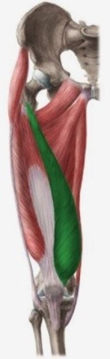 <p>O: labium mediale van linea aspera</p><p>V: vezels draaien langs mediaal</p><p>I: retinaculum patellae mediale</p><p>tuberositas tibiae Inn: N. femoralis (L2-L3-L4)</p>