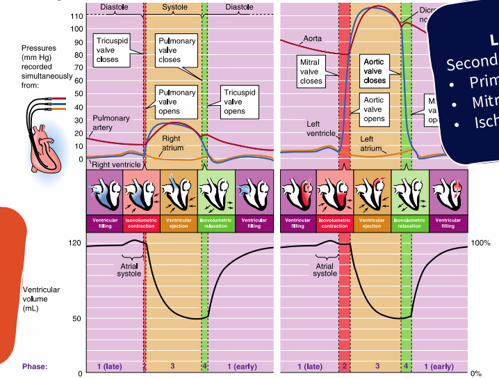 <p>Congestive Heart Failure (CHF): Secondary to other conditions</p>