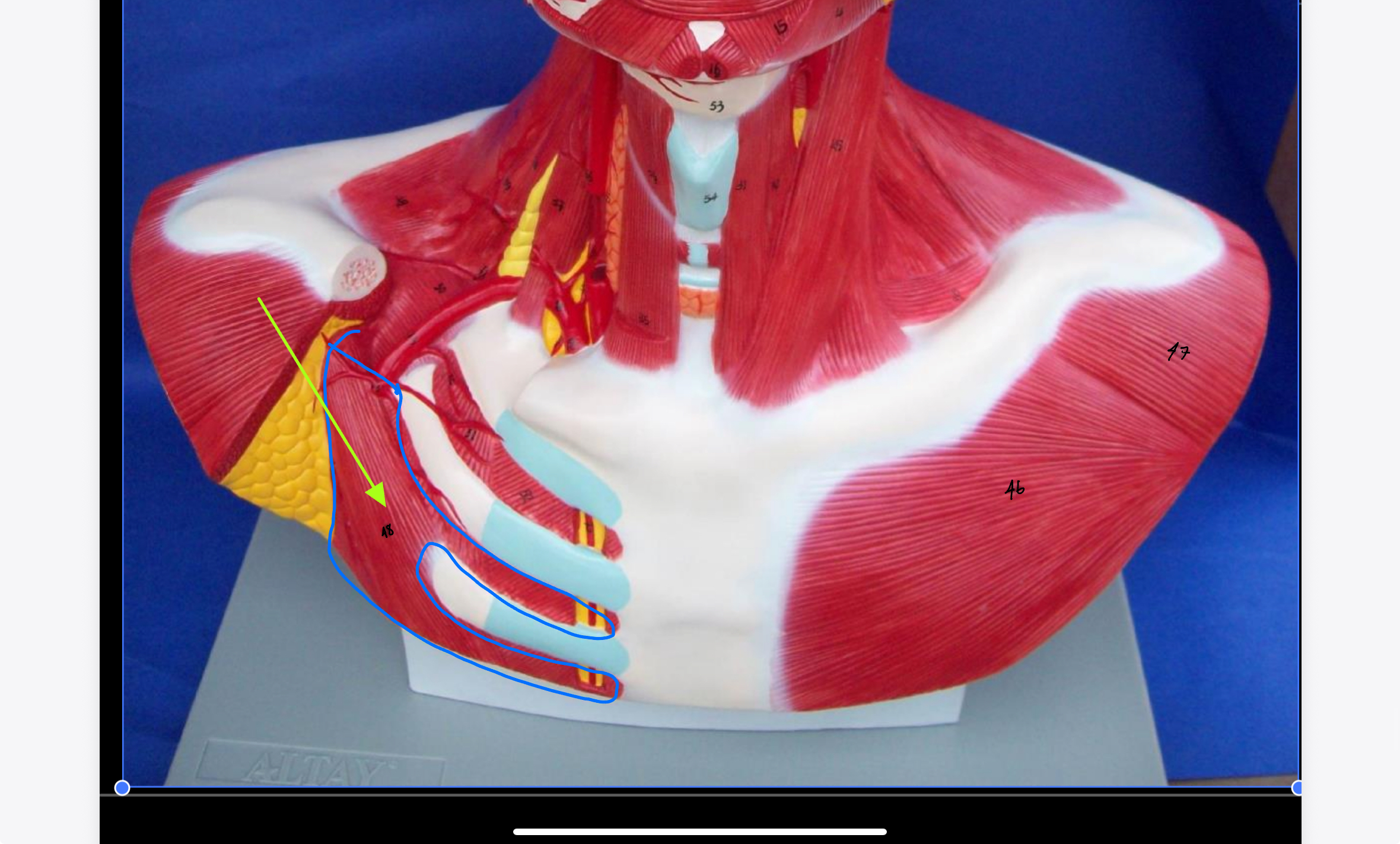 <p>What type of muscle is this ( altay model )</p>