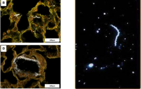 <ul><li><p><strong>image syphilis</strong></p></li><li><p><u>studying external details</u> </p></li><li><p>tiny diffracting objects like bacteria and isolated organelles</p></li></ul><p></p>