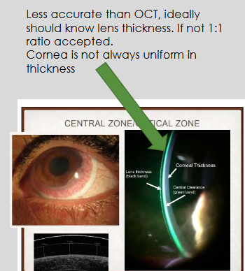 <ul><li><p>Less accurate than OCT</p></li><li><p>Ideally, lens thickness should be known; if not, a 1:1 ratio is accepted</p></li><li><p>Corneal thickness is not always uniform, which can affect assessment</p></li></ul><p></p>