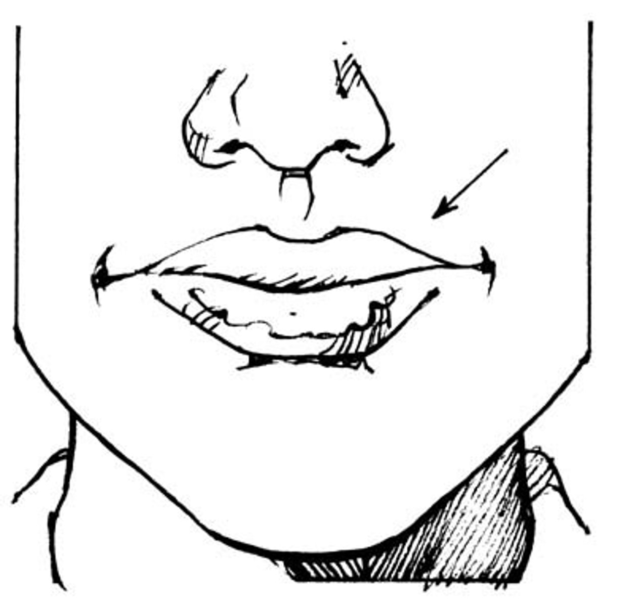 <p>lips</p>