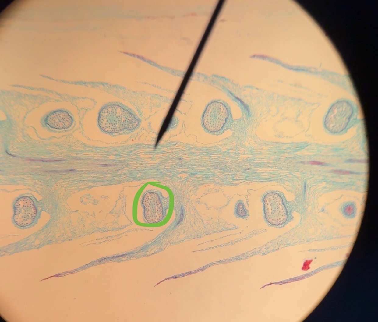 <p>What is the green circle </p>