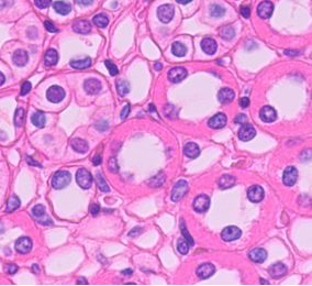 <p>What type of tissue is this? </p>