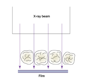 <ul><li><p>central ray 90 degrees to curvature of arch and through contact areas of teeth</p></li><li><p>if incorrect: overlapped contact areas, can’t be used to examine the interprox. </p></li></ul><p></p>
