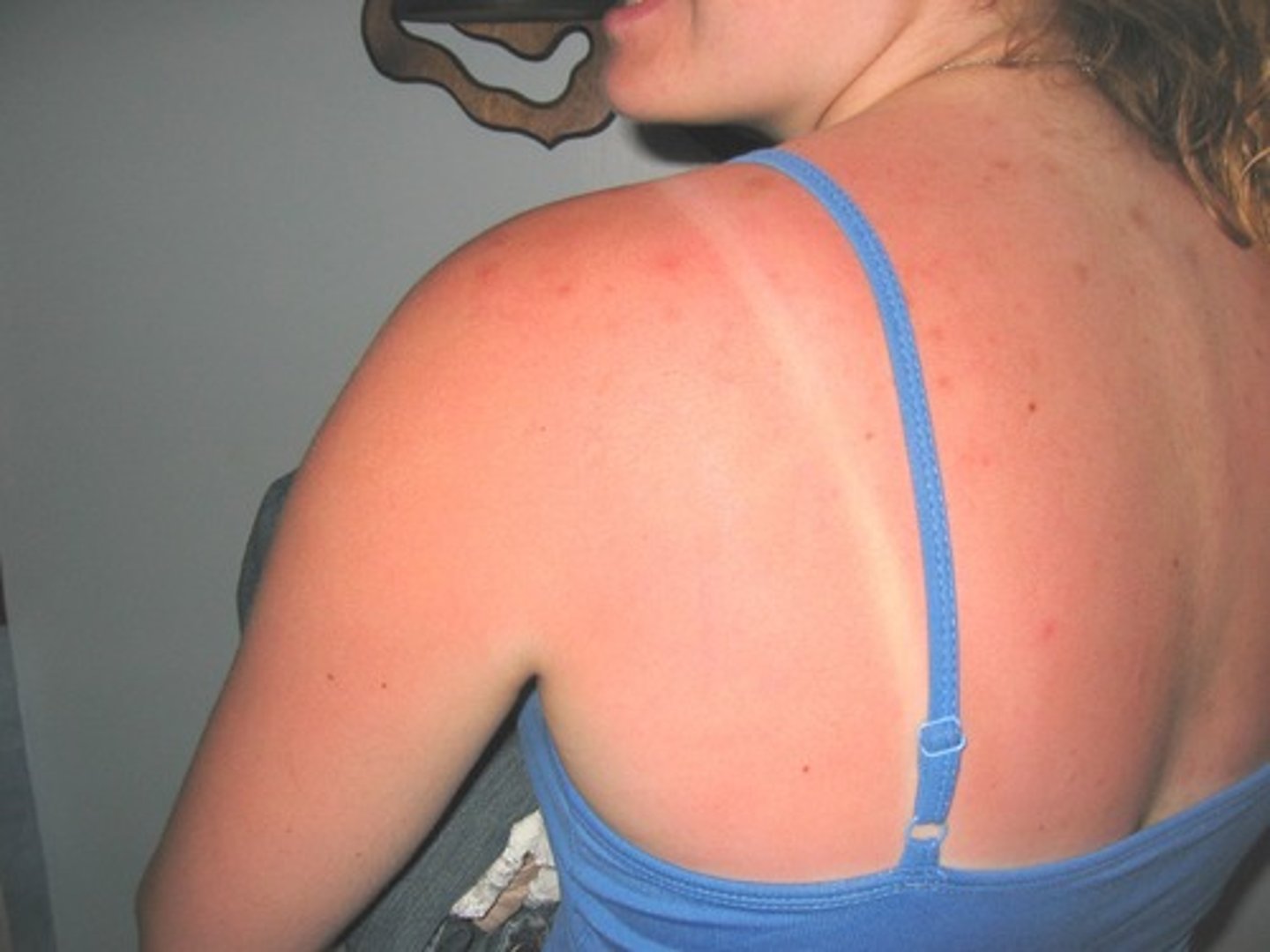 <p>to burn oneself</p>
