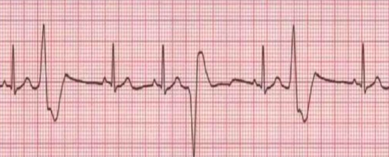 <p>what is this?</p>