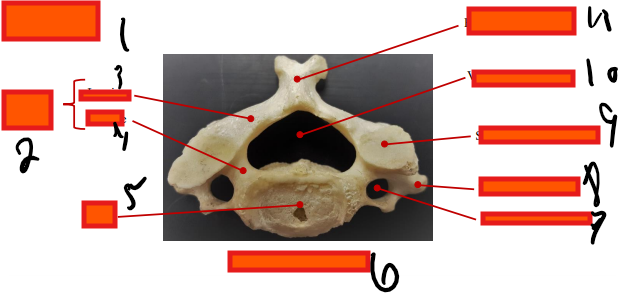 <p>Where is the transverse process?</p>