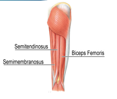<p><strong>Hamstring Strain: Background</strong></p><p>-Hamstrings</p><ul><li><p>Biceps femoris, semitendinosus, semimembranosus</p></li><li><p>____ knee and ______ hip; some internal/external rotation</p></li></ul><p>-Risk Factors</p><ul><li><p>Inadequate warm up, muscle _______, muscle weakness/________, poor biomechanics, and previous injury </p></li></ul><p>-Mechanism of Injury </p><ul><li><p>Most occur during high speed _________</p></li><li><p>_____ _______ is the most commonly injured </p></li></ul><p></p>