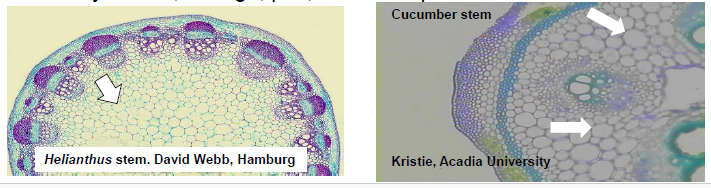 <ul><li><p>thin primary cell walls (usually lignified)</p></li><li><p>contain nucleus, cytoplasm, and vacuoles</p></li><li><p>involved in photosynthesis, storage, and local transport</p></li></ul><p></p>