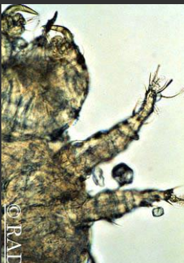 <ul><li><p>21 day life span</p></li><li><p><span style="color: rgb(136, 136, 136);"><strong>Et:</strong></span><strong> </strong>dogs (C yasguri), cats (C blakei), rabbits (C parasitovorax), humans (zoonotic)</p></li><li><p><span style="color: rgb(136, 136, 136);"><strong>Id: </strong></span>4 pairs of legs w/ combs (not claws), <strong><u>accessory mouthparts, palpi w/ hooks </u></strong></p><ul><li><p>larva → 6 legs, adults → 8 legs</p></li></ul></li><li><p><span style="color: rgb(136, 136, 136);"><strong>Cs:</strong></span><strong> pruritus, hypersensitivity, scale, dorsal alopecia, oily coat</strong></p></li><li><p><span style="color: rgb(136, 136, 136);"><strong>Dt: </strong></span>superficial scrape, combing, tape preps, <u>fecal floats (cats)</u></p></li><li><p><span style="color: rgb(136, 136, 136);"><strong>Tx: </strong></span>flea control, Frontline, Revolution, Advantage-multi, lime sulfur dips, ivermectin, milbemycin</p><ul><li><p>if Tx fails check for nasal seq</p></li></ul></li></ul><p></p>