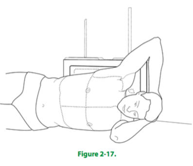 (D) the CR is directed vertically to the level of T7