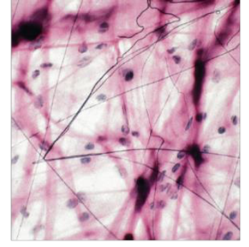 <p>Identify the tissue type based off the image below </p>
