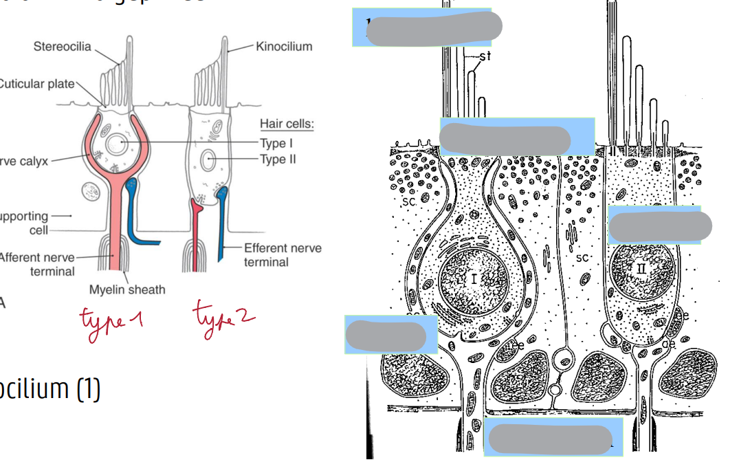 <p>HAARCELLEN: 2 TYPES</p>