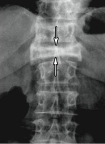 <p></p>