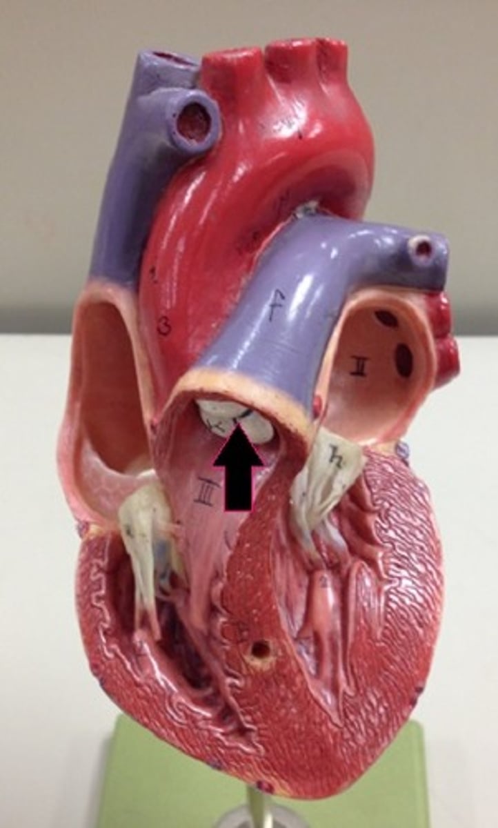 <p>Identify the valve.</p>