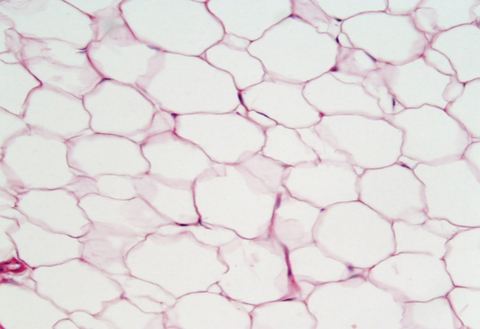 <p>What substance is stored? Fat</p><p>Location: Under skin, behind eyes, kidneys, abdominal membranes</p><p>Function: Insulate, pad and as a heat energy reserve</p>