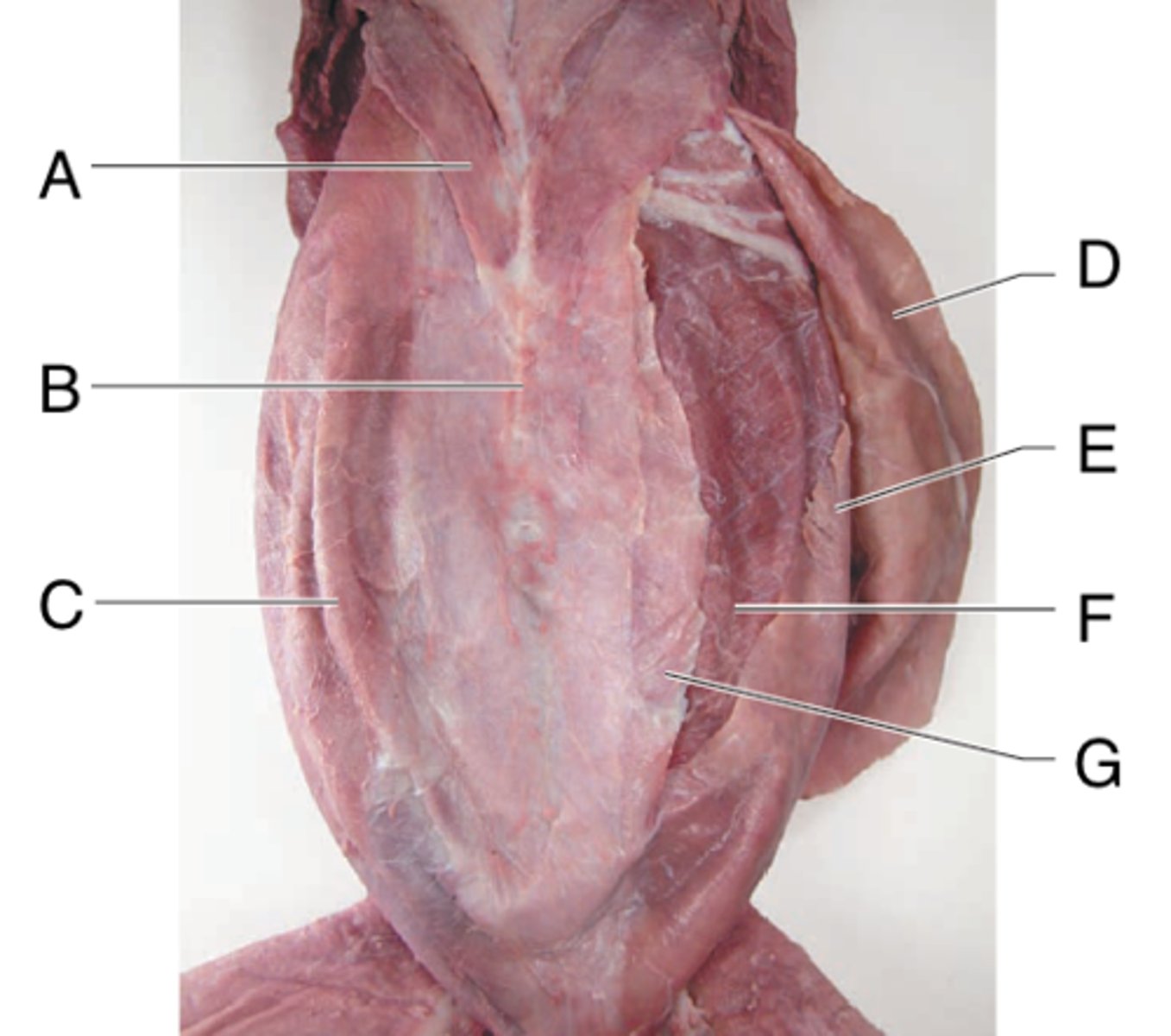 <p>What is the muscle indicated by letter G? What is an attachment point and function?</p>