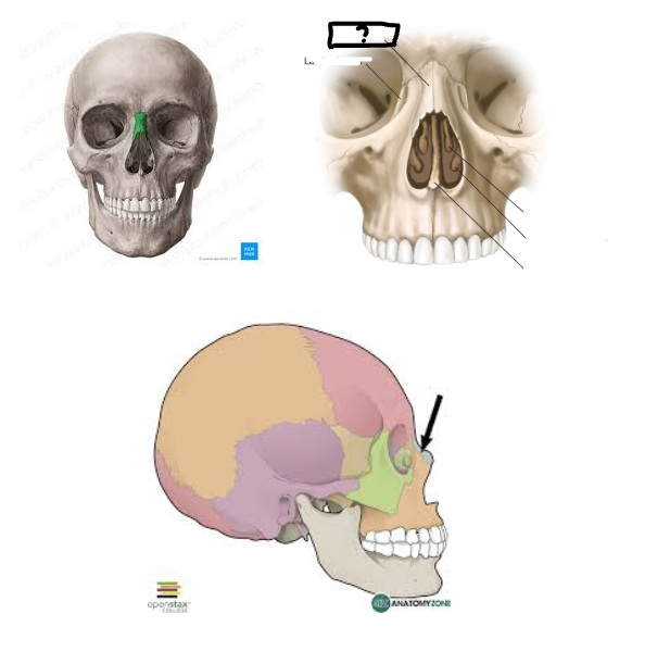 <p>NOSE BONE </p>