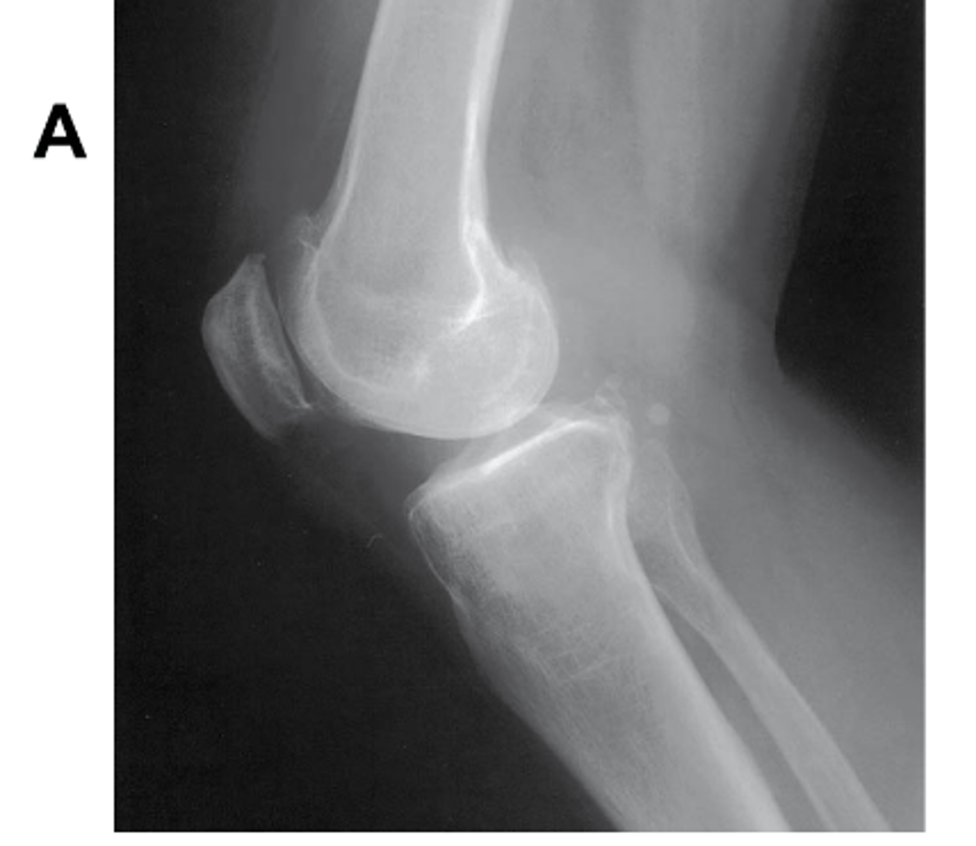 <p>Is there an angle on the CR in this projection? (Be prepared to explain how you know on the quiz)</p>