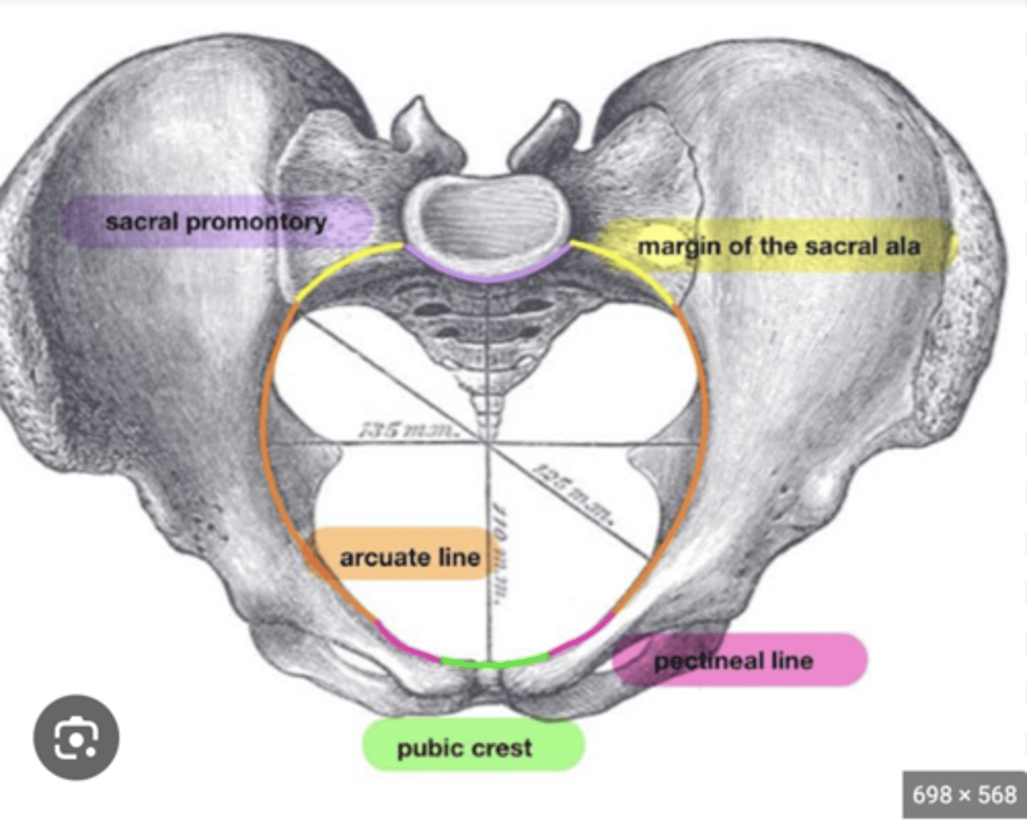 <p>What is the pelvic inlet bounded by? (3)</p>