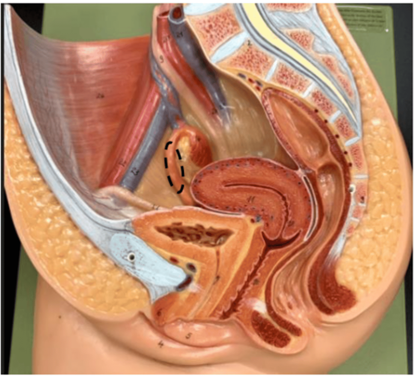 <p>surrounds ovary</p>
