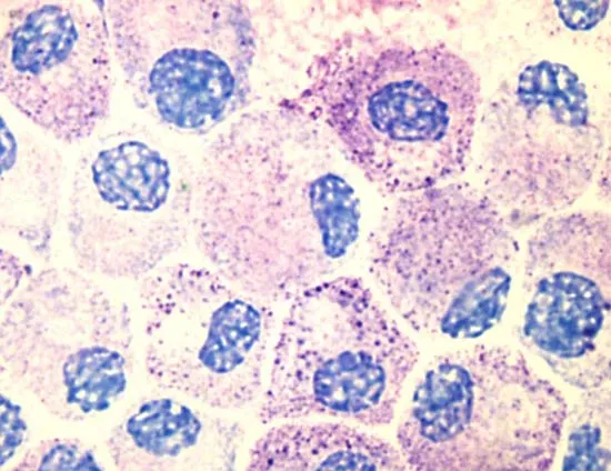 <p><span style="font-family: Georgia, serif">Cells that <strong>mediate </strong></span><strong>inflammatory responses</strong><span style="font-family: Georgia, serif"> such as </span>hypersensitivity<span style="font-family: Georgia, serif"> and </span><strong>allergic</strong> reactions<span style="font-family: Georgia, serif">.</span></p>