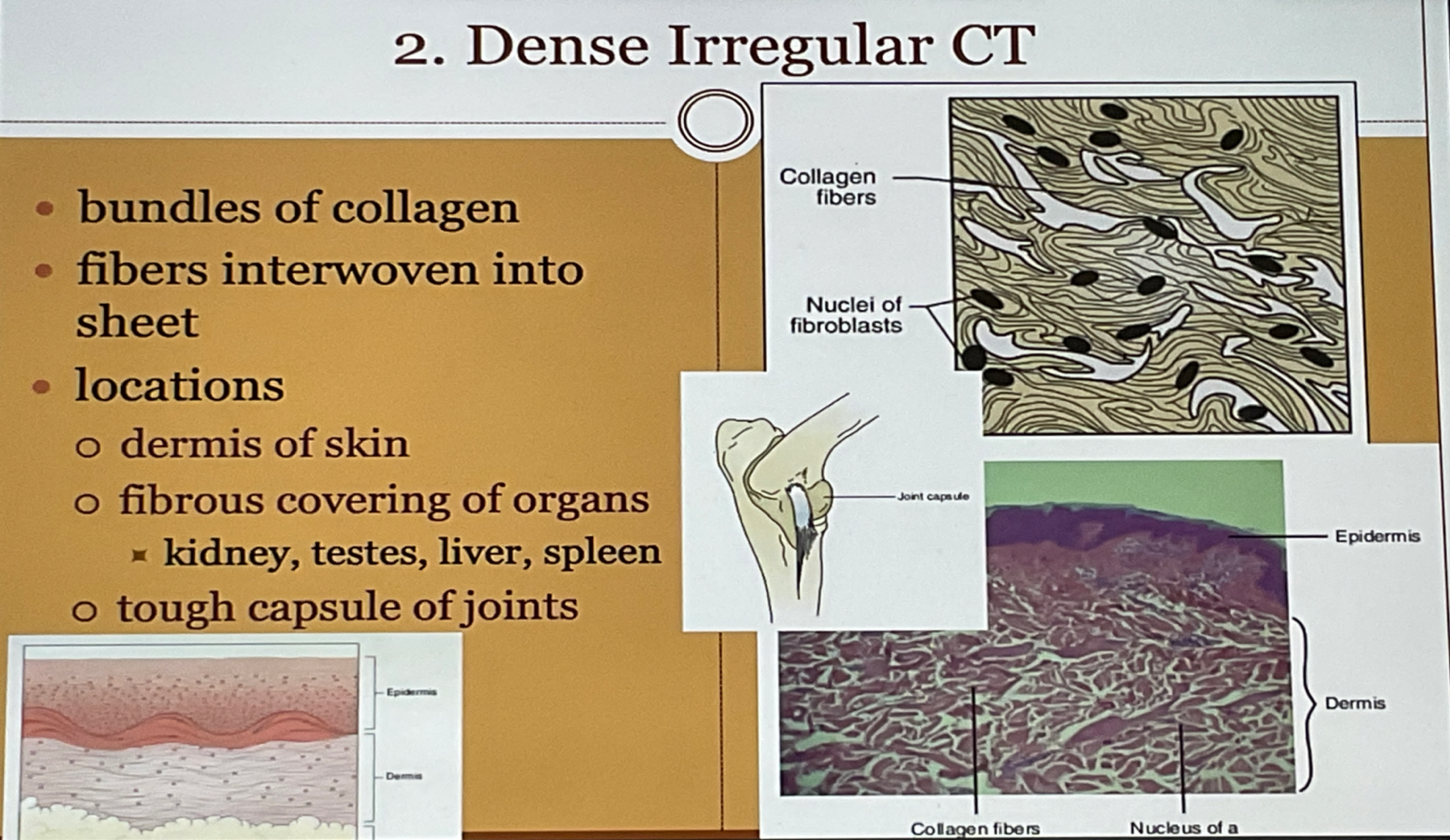 Dense Irregular CT 