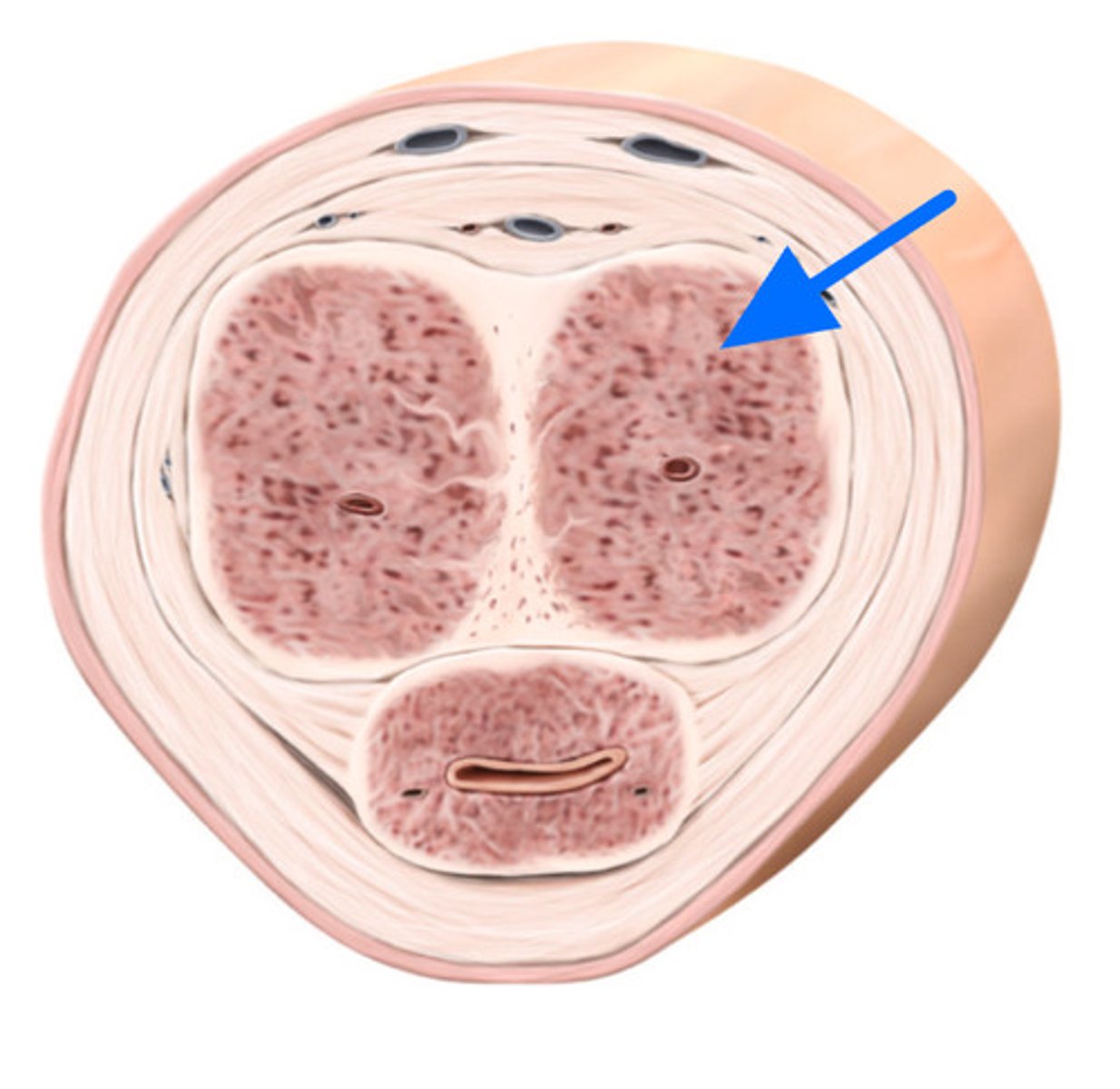 <p>ID Structure Marked with the Blue Arrow</p>