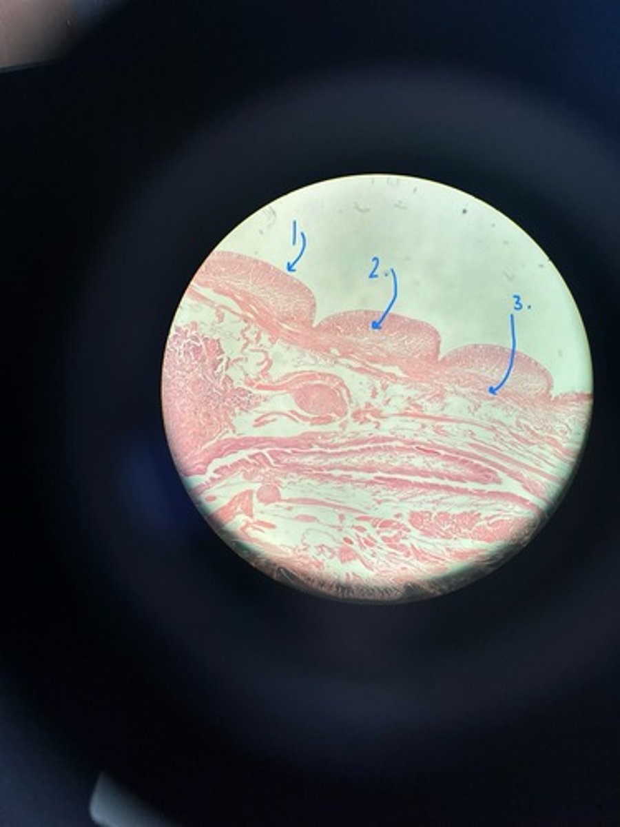 <p>On the Lumbricus terrestris where is the cuticle, circular muscles, and longitudinal muscles?</p>