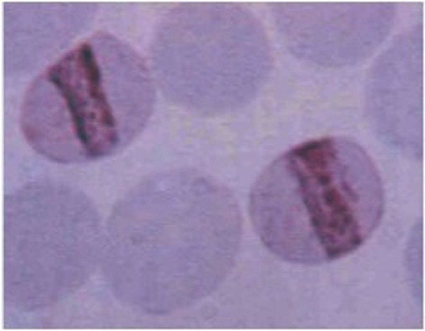<p>thicker ring, compact trophozoite, schizonts have &lt;12 merozoites</p>