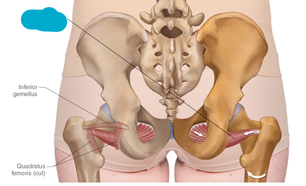 <p>name the blue muscle</p>