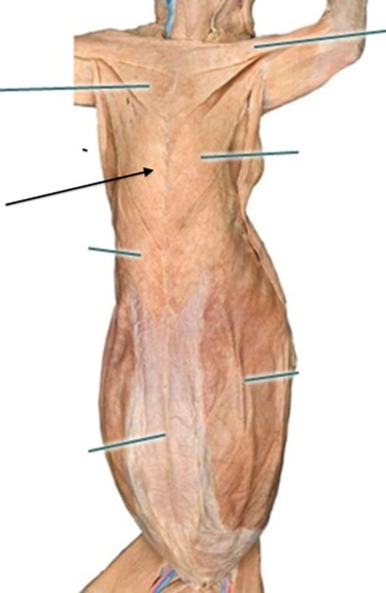 <p>-largest in cat, but not in man</p><p>-originates-mid and posterior sternum</p><p>-inserts on humerus</p><p>-function: Draws forelimb toward the midline</p>