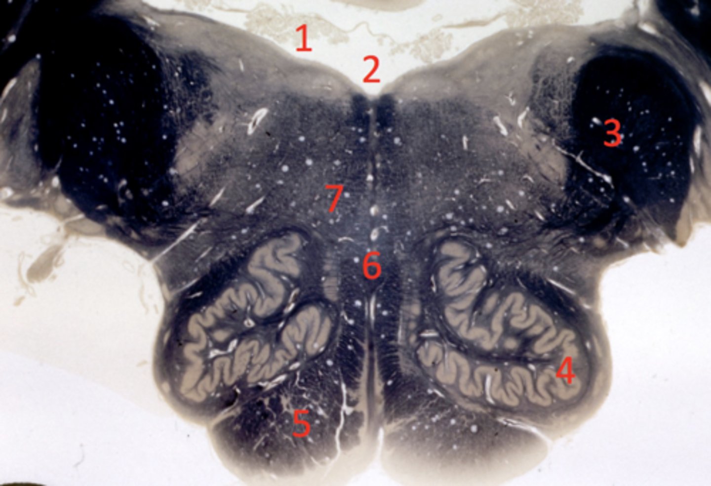 <p>choroid plexus</p>