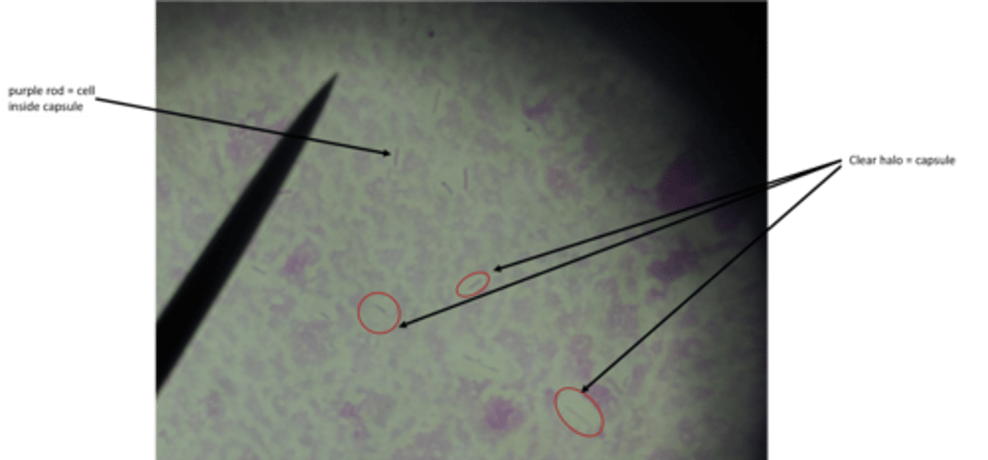 <p>what type of stain is this?</p>