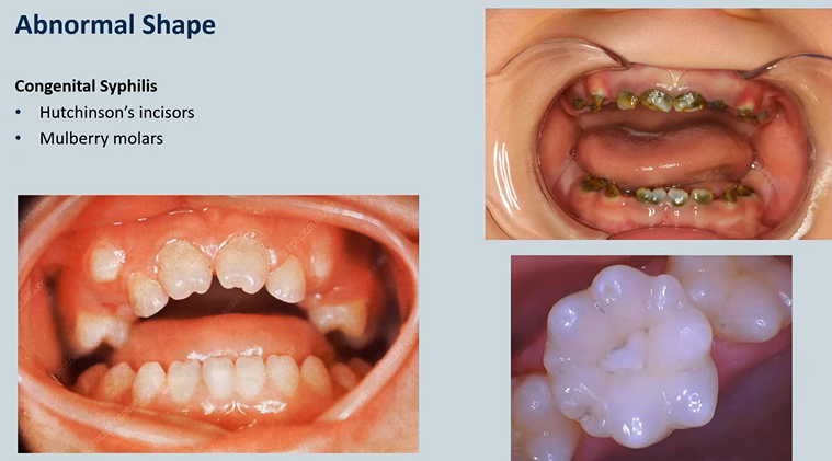 <p>what is this an example of?</p>