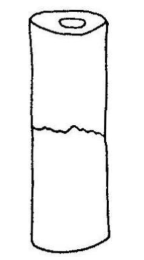 what loading type causes this bone failure