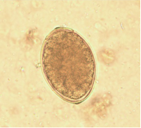 ____________________ in an unstained wet mount of stool.