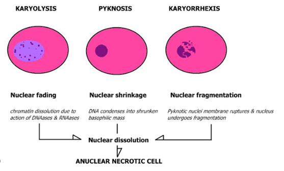 <p>Pyknos – förtjockning; Rhexis – spricka; Lysis – upplösning; sker vid apoptos</p>