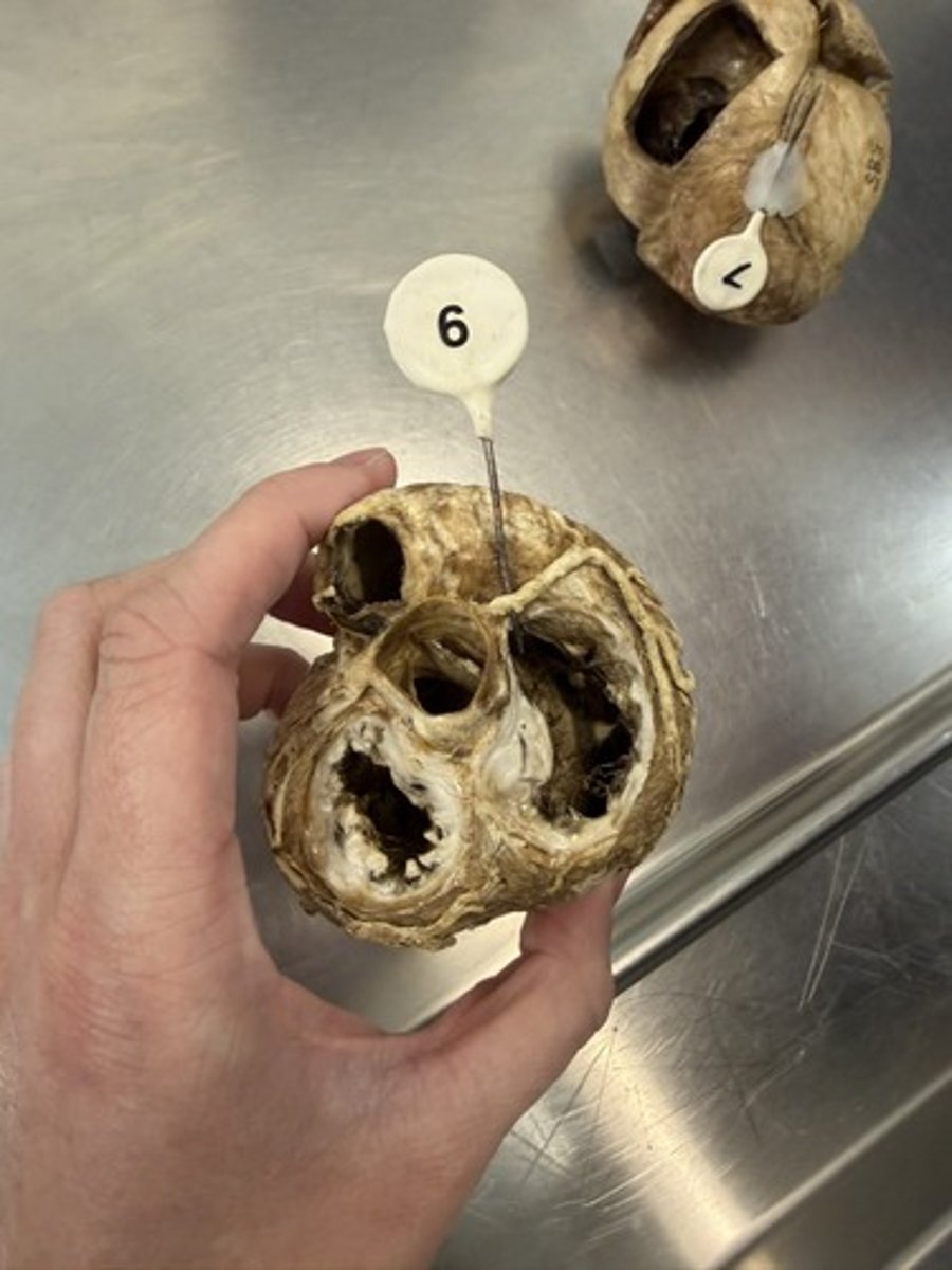 <p>A. ID the vessel adjacent to the pin.</p><p>B. From which part of the aorta does it arise?</p>