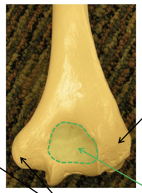 <p>The image depicts the ____ view of the distal humerus.</p>