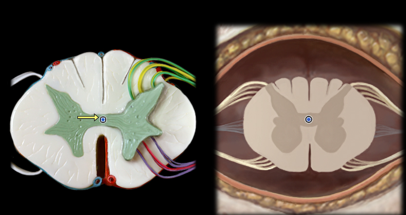 <p>Central canal of spinal cord</p>
