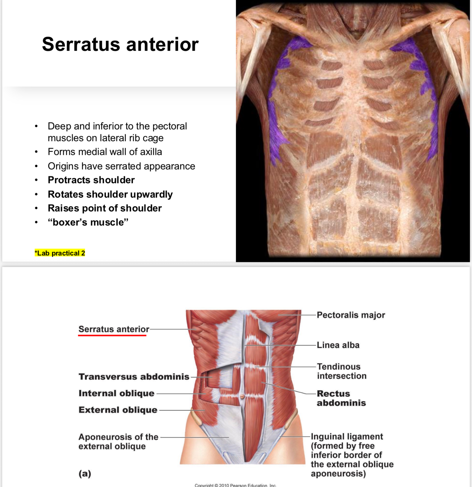 <p>Muscle that protracts the shoulder and rotates it upwards; known as the 'boxer's muscle'.</p>