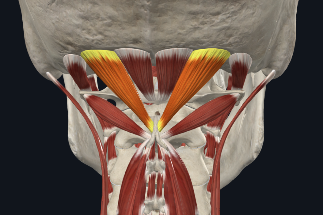<p><strong>Nombre alterno: </strong>X</p><p><strong><mark data-color="yellow" style="background-color: yellow; color: inherit">Origen: </mark></strong><mark data-color="yellow" style="background-color: yellow; color: inherit">Apófisis espinosa C2 (axis)</mark></p><p><strong><mark data-color="blue" style="background-color: blue; color: inherit">Inserción: </mark></strong><mark data-color="blue" style="background-color: blue; color: inherit">Línea nucal inferior</mark></p><p><strong><mark data-color="red" style="background-color: red; color: inherit">Acción: </mark></strong><mark data-color="red" style="background-color: red; color: inherit">Extensión suave de la cabeza (´sup). Rotación leve.</mark></p><p><strong><mark data-color="purple" style="background-color: purple; color: inherit">Inervación: </mark></strong><mark data-color="purple" style="background-color: purple; color: inherit">Plexo cervical</mark><strong><br><mark data-color="green" style="background-color: green; color: inherit">Relaciones: </mark></strong><mark data-color="green" style="background-color: green; color: inherit">X</mark></p><p><strong>Notas:</strong></p><p>Si forma parte del triángulo suboccipital</p>