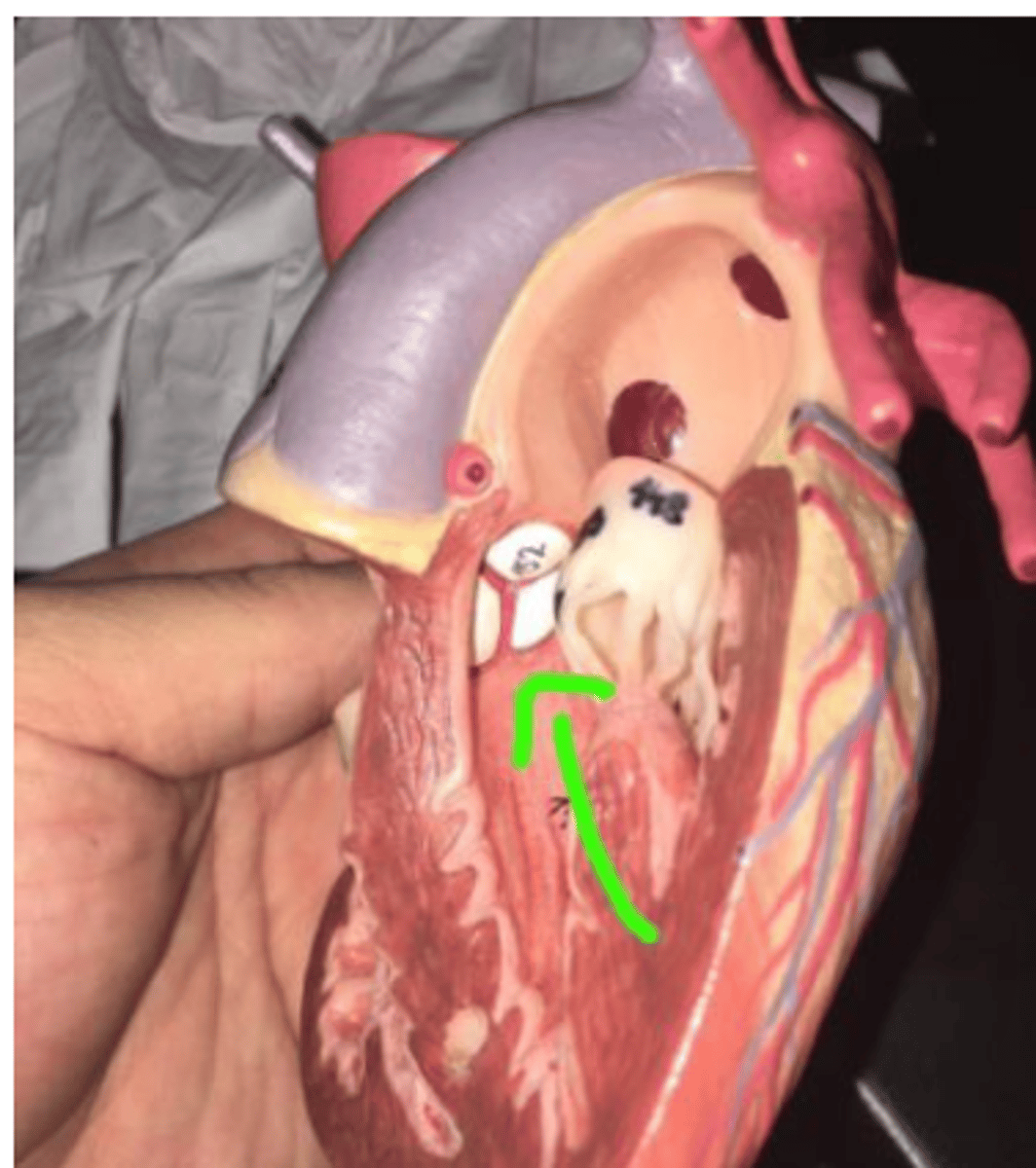 <p>valve inside the ascending aorta (no strings attached)</p>